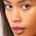 Does Cheek Filling Get Worse Under the Eyes?